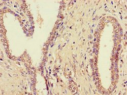 Invitrogen ZDHHC1 Polyclonal Antibody 100 &mu;g; Unconjugated:Antibodies,