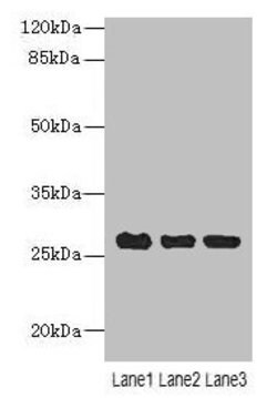 Invitrogen C10orf82 Polyclonal Antibody 100 &mu;g; Unconjugated:Antibodies,