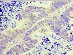 Invitrogen GLYATL1 Polyclonal Antibody 100 μL; Unconjugated:Antibodies,