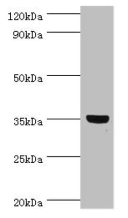 Invitrogen GLYATL1 Polyclonal Antibody 100 μL; Unconjugated:Antibodies,
