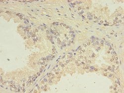 Invitrogen CEP63 Polyclonal Antibody 100 μg; Unconjugated:Antibodies,
