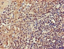 Invitrogen C22orf13 Polyclonal Antibody 100 &mu;g; Unconjugated:Antibodies,