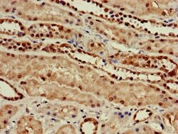 Invitrogen C22orf13 Polyclonal Antibody 100 &mu;g; Unconjugated:Antibodies,