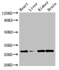 Invitrogen C22orf13 Polyclonal Antibody 100 &mu;g; Unconjugated:Antibodies,