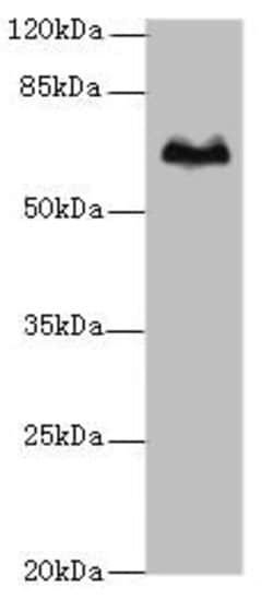 Invitrogen TBX15 Polyclonal Antibody 100 &mu;g; Unconjugated:Antibodies,