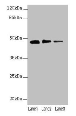 Invitrogen PRSS35 Polyclonal Antibody 100 μg; Unconjugated:Antibodies,
