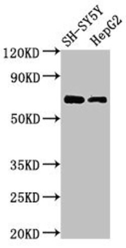 Invitrogen C7orf31 Polyclonal Antibody 100 &mu;g; Unconjugated:Antibodies,