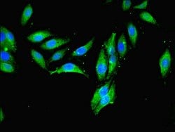 Invitrogen MCPH1 Polyclonal Antibody 100 &mu;L; Unconjugated:Antibodies,