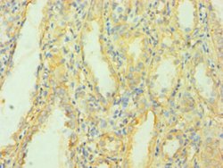 Invitrogen MCPH1 Polyclonal Antibody 100 &mu;L; Unconjugated:Antibodies,