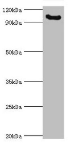 Invitrogen MCPH1 Polyclonal Antibody 100 &mu;L; Unconjugated:Antibodies,
