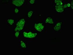 Invitrogen UHMK1 Polyclonal Antibody 100 μg; Unconjugated:Antibodies,