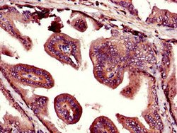 Invitrogen UHMK1 Polyclonal Antibody 100 μg; Unconjugated:Antibodies,