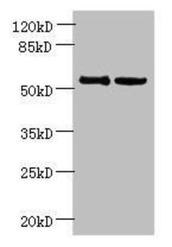 Invitrogen UTP15 Polyclonal Antibody 100 &mu;g; Unconjugated:Antibodies,