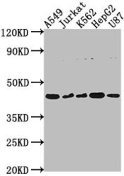 Invitrogen DNASE2B Polyclonal Antibody 100 μL; Unconjugated:Antibodies,