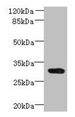 Invitrogen CCDC127 Polyclonal Antibody 100 μg; Unconjugated:Antibodies,
