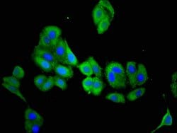 Invitrogen ACY3 Polyclonal Antibody 100 &mu;g; Unconjugated:Antibodies,