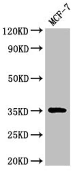 Invitrogen ACY3 Polyclonal Antibody 100 &mu;g; Unconjugated:Antibodies,