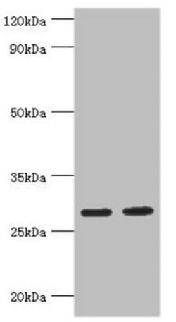 Invitrogen UBE2J2 Polyclonal Antibody 100 &mu;L; Unconjugated:Antibodies,
