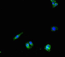 Invitrogen PNPLA1 Polyclonal Antibody 100 &mu;g; Unconjugated:Antibodies,