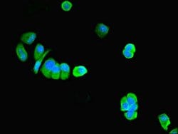 Invitrogen PNPLA1 Polyclonal Antibody 100 &mu;g; Unconjugated:Antibodies,