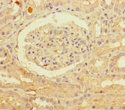 Invitrogen PNPLA1 Polyclonal Antibody 100 &mu;g; Unconjugated:Antibodies,