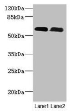 Invitrogen PNPLA1 Polyclonal Antibody 100 &mu;g; Unconjugated:Antibodies,