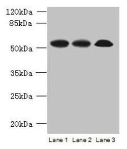 Invitrogen SPERT Polyclonal Antibody 100 &mu;g | Buy Online | Invitrogen&trade; | Fisher Scientific