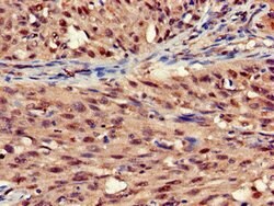 Invitrogen STOML3 Polyclonal Antibody 100 μg; Unconjugated:Antibodies,