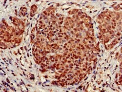 Invitrogen STOML3 Polyclonal Antibody 100 μg; Unconjugated:Antibodies,