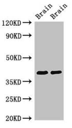 Invitrogen STOML3 Polyclonal Antibody 100 μg; Unconjugated:Antibodies,