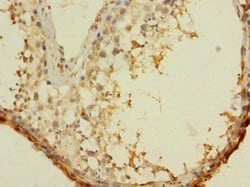 Invitrogen ASZ1 Polyclonal Antibody 100 &mu;g; Unconjugated:Antibodies,