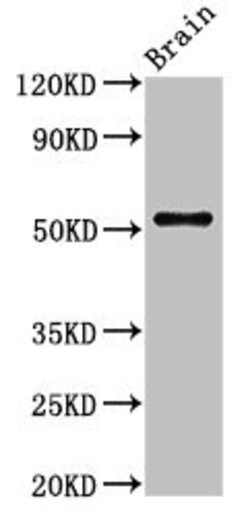 Invitrogen ASZ1 Polyclonal Antibody 100 &mu;g; Unconjugated:Antibodies,