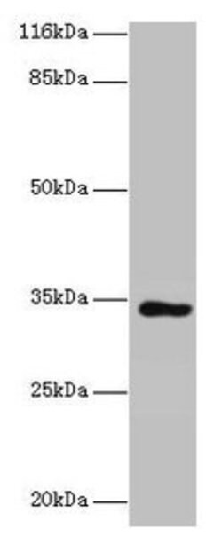 Invitrogen KIAA1191 Polyclonal Antibody 100 &mu;g; Unconjugated:Antibodies,