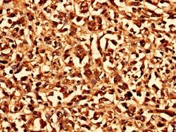 Invitrogen CHMP6 Polyclonal Antibody 100 &mu;g; Unconjugated:Antibodies,