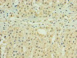 Invitrogen HYLS1 Polyclonal Antibody 100 μL; Unconjugated:Antibodies,