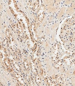 Invitrogen Ubiquitin Polyclonal Antibody 400 μL; Unconjugated:Antibodies,