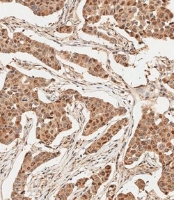 Invitrogen Ubiquitin Polyclonal Antibody 400 μL; Unconjugated:Antibodies,