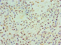 Invitrogen CaMKI gamma Polyclonal Antibody 100 &mu;L; Unconjugated:Antibodies,