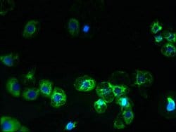 Invitrogen SLC38A2 Polyclonal Antibody 100 &mu;g; Unconjugated:Antibodies,