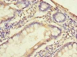 Invitrogen SLC38A2 Polyclonal Antibody 100 &mu;g; Unconjugated:Antibodies,