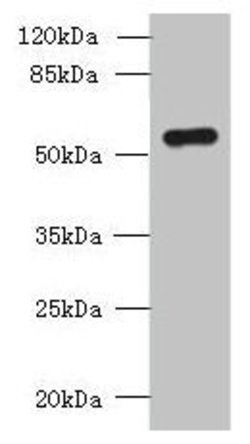 Invitrogen SLC38A2 Polyclonal Antibody 100 &mu;g; Unconjugated:Antibodies,