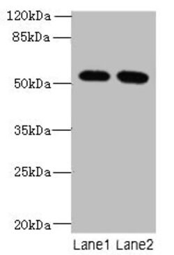 Invitrogen VWA9 Polyclonal Antibody 100 μg; Unconjugated:Antibodies,