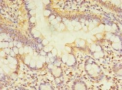 TCP11L2 Polyclonal Antibody:Antibodies, Polyclonal