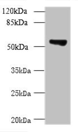TCP11L2 Polyclonal Antibody:Antibodies, Polyclonal