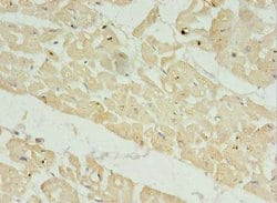 FA156 Polyclonal Antibody:Antibodies, Polyclonal