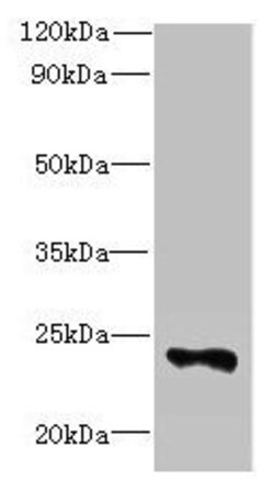 FA156 Polyclonal Antibody:Antibodies, Polyclonal