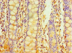 Invitrogen PIGX Polyclonal Antibody 100 &mu;g; Unconjugated:Antibodies,