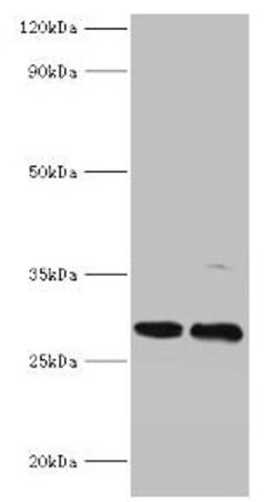 Invitrogen PIGX Polyclonal Antibody 100 &mu;g; Unconjugated:Antibodies,
