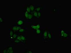 Invitrogen FBXO25 Polyclonal Antibody 100 &mu;g | Buy Online | Invitrogen&trade; | Fisher Scientific