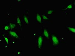Invitrogen FBXO25 Polyclonal Antibody 100 &mu;g | Buy Online | Invitrogen&trade; | Fisher Scientific